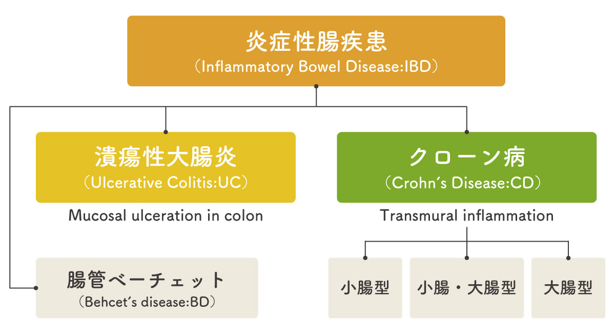 淀川区うえだクリニックでのIBDの分類図
