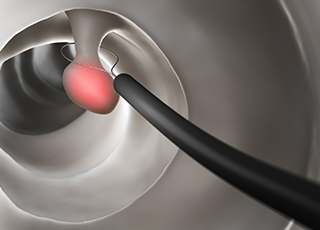 大腸内視鏡検査の時間は、13:00-15:30です。